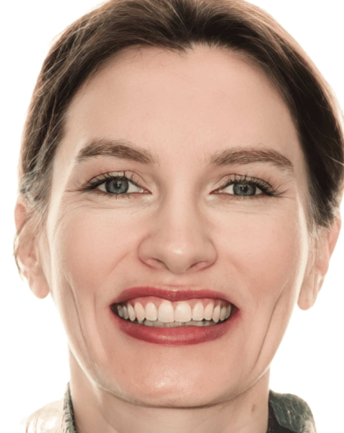 Angélique_Visage _Après