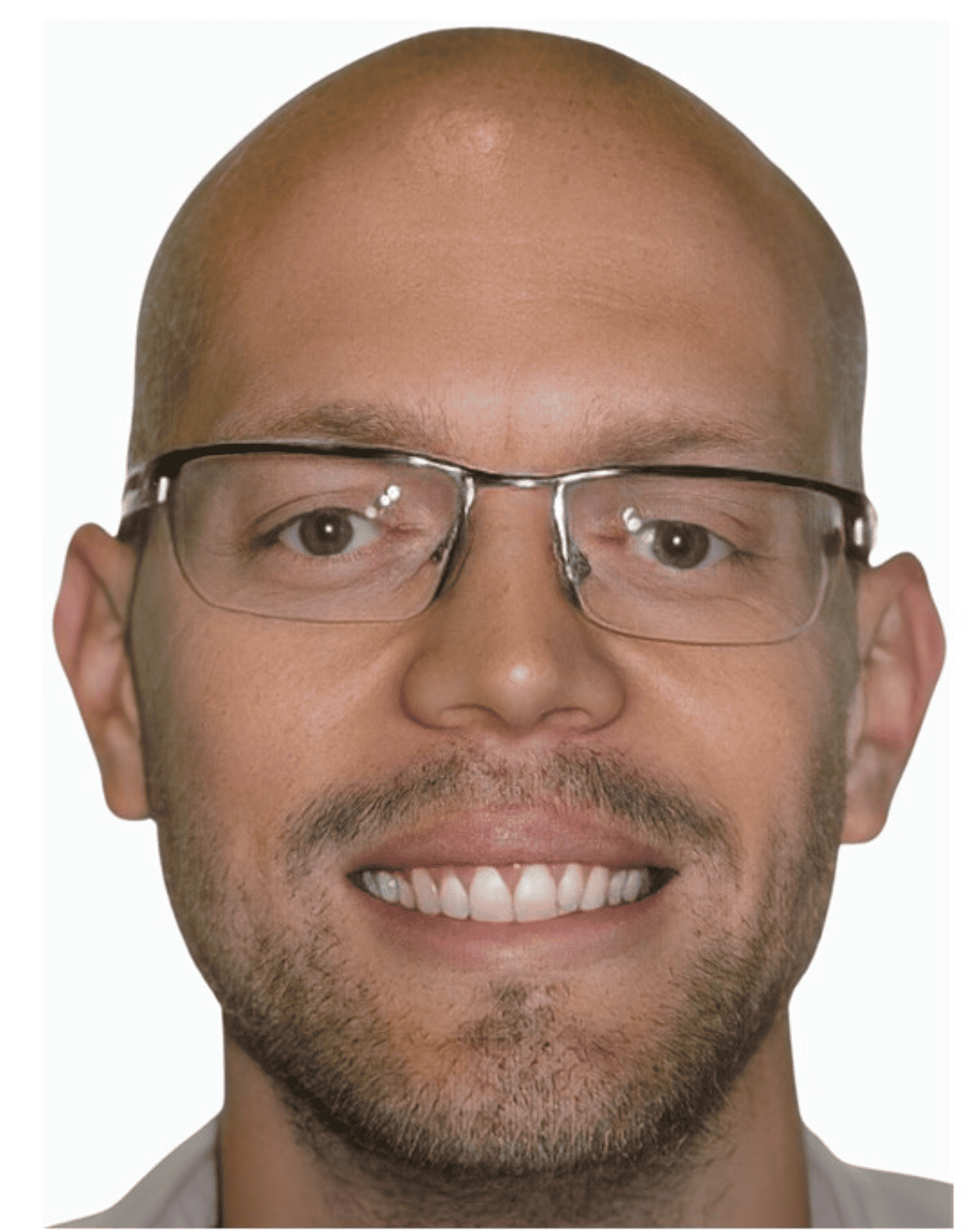 Hervé_Visage F_Avant